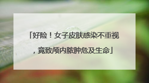 好险！女子皮肤感染不重视，竟致颅内脓肿危及生命